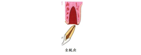 5.png